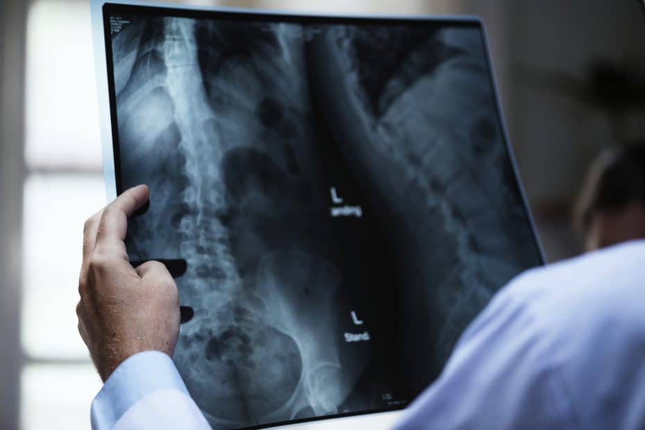 doctor evaluando radiografias del paciente